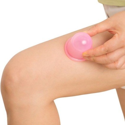 UNIQ Cupping Massage Suction, 2 Stuks - Anti Cellulite